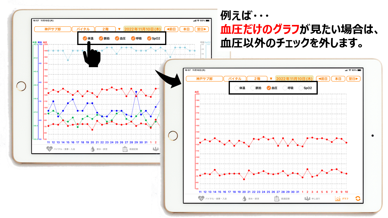 iPadアプリのグラフ画面でバイタル項目ごとにチェックマークを入れられるようになった画面イメージ